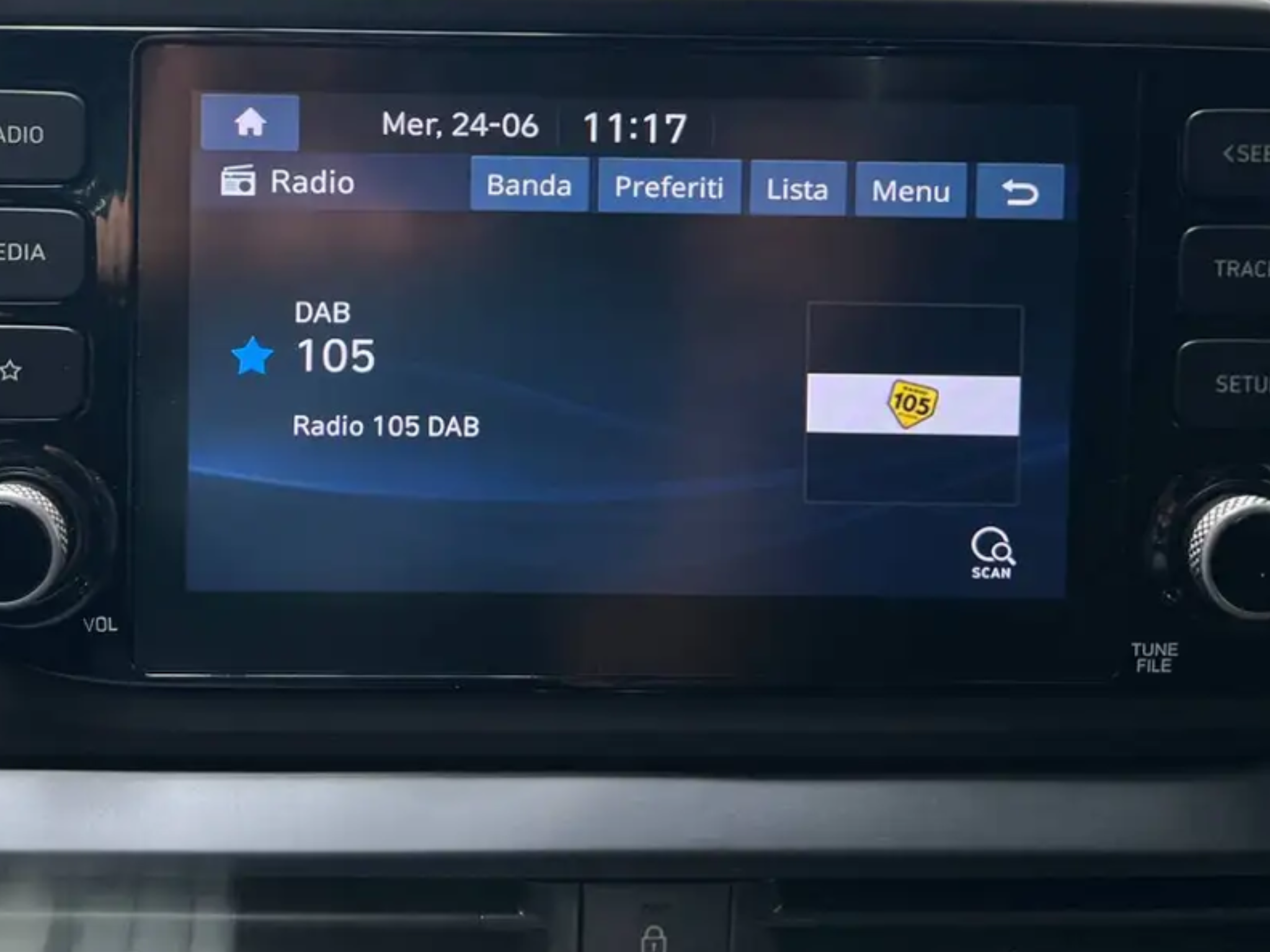 HYUNDAI i 20 1.6 T-GDI N PERFORMANCE 204CV